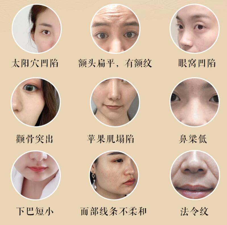 宫廷古方:12节徒手小脸塑颜术插图 宫廷古方:12节徒手小脸塑颜术插图