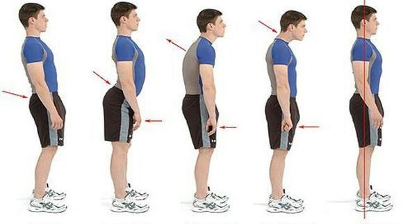 【黄博士爱健康】二十一天改善圆肩驼背特训营插图