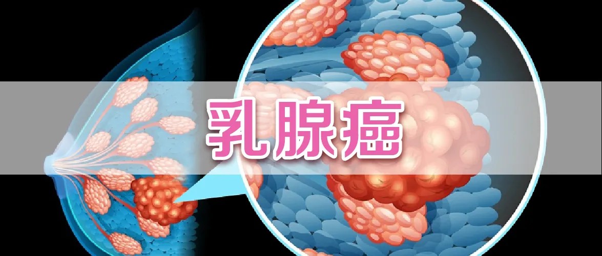 哺乳半年以上有助预防乳腺癌 如何有效防治乳腺癌？插图