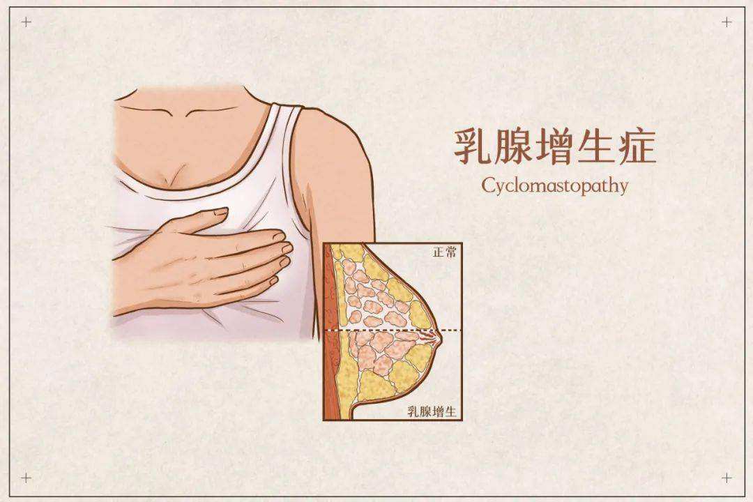 中医是怎样治疗乳腺增生的？ 少吃红肉或有助预防乳腺癌插图