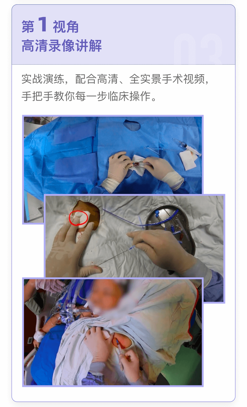 《百穿百中：深静脉穿刺三十六计》手把手教你解决深静脉穿刺难点全面掌握盲穿和超声下穿刺技巧插图2