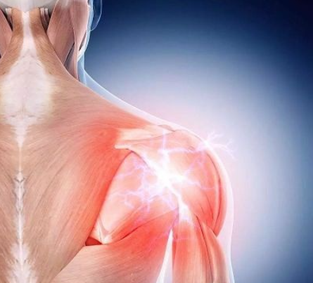 《 每天3分钟，带你学习康复师必会的37个特殊检查》精选人体评估中颈、肩、腰、膝4大重点部位插图