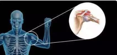 《 每天3分钟，带你学习康复师必会的37个特殊检查》精选人体评估中颈、肩、腰、膝4大重点部位插图1