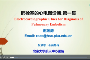 壹生大学赵运涛《肺栓塞心电图诊断》视频讲座共3讲 百度云下载