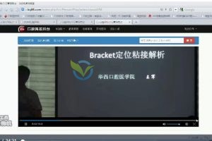 华西口腔医院-托槽定位粘结解析视频课程