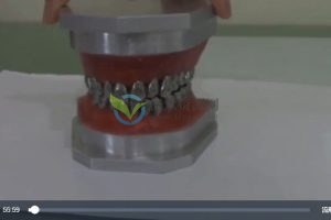 武广增正畸课最终完工版视频 百度云下载