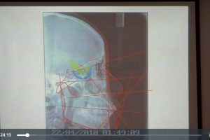 正畸中级班MRC课程视频共2.5小时