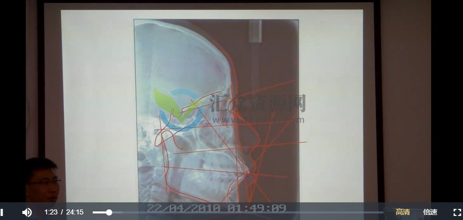 正畸中级班MRC课程视频共2.5小时插图