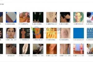 中国针灸学30集视频讲座