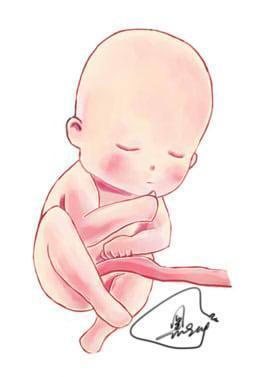 孕期胎儿脐带绕颈怎么办 孕妇平时应该注意什么插图1