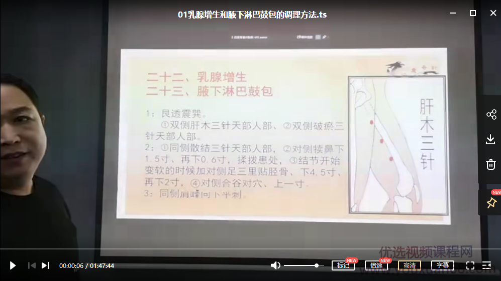 刘涛心意奇针三天针灸课程